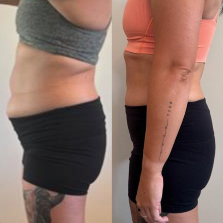 AE results